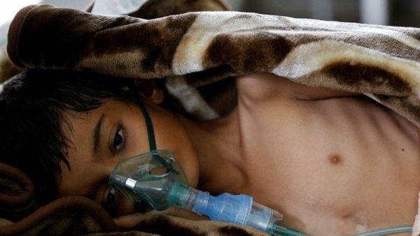 Saudi-led coalition’s attack on the #Yemeni port city of Hudaydah could have catastrophic consequences for civilians (Twitter)