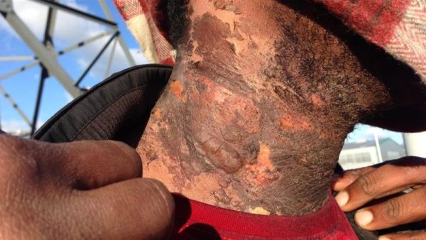 There have been nearly 1,000 human rights violations by French police (Twitter)