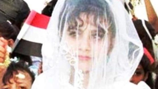 زواج القاصرات يمثل مشكلة حقيقية في اليمن.