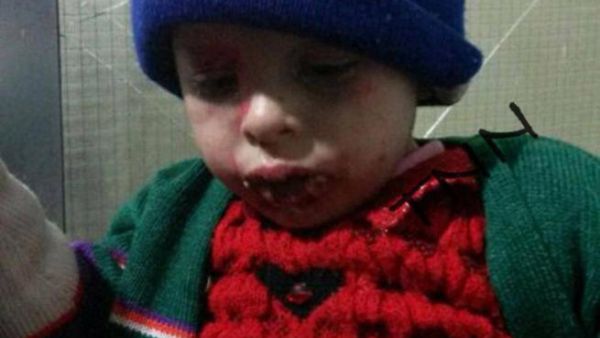 الطفلة اللبنانية المعنّفة قمر الأعور