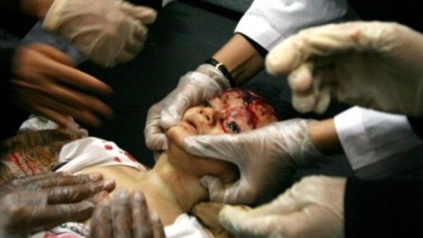 طفل قتل برصاص قناصة النظام في اليمن. طفل قتل برصاص قناصة النظام في اليمن.