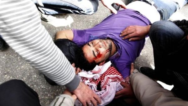 أحد المصابين بحجارة البلطجيه في يوم جمعة 25 آذار في العاصمة الأردنية عمان.