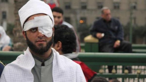 جمعة العين الواحدة في مصر.