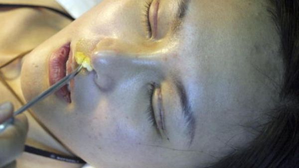 عمليات التجميل منتشرة جدا في لبنان. عمليات التجميل منتشرة جدا في لبنان.