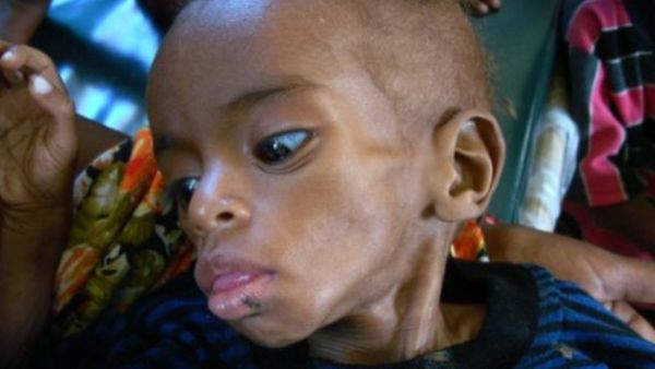 الإنسان هو السبب الأول لجوع أخيه الإنسان. الإنسان هو السبب الأول لجوع أخيه الإنسان.