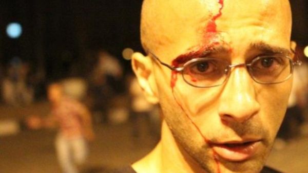 أحد المصابين في الاصطدامات بين المتظاهرين وقوات الأمن في ميدان التحرير المصري ليلة أمس. أحد المصابين في الاصطدامات بين المتظاهرين وقوات الأمن في ميدان التحرير المصري ليلة أمس.