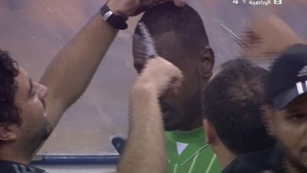 حكم سعودي يحاول حلق شعر لاعب لاعتراضه على قصة شعره