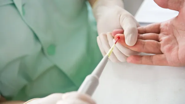 A new device is capable of screening blood that captures 3.5 times the number of cancer cells as the current method. (Shutterstock)