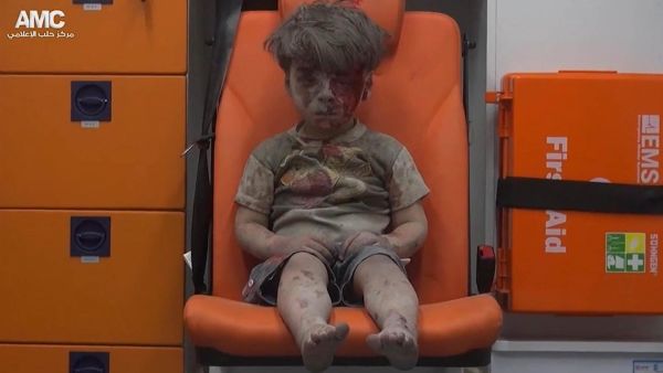 The now famous image of Omran Daqneesh in Aleppo (Aleppo Media Center)