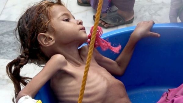 Time is running out for aid groups working in Yemen (Twitter)