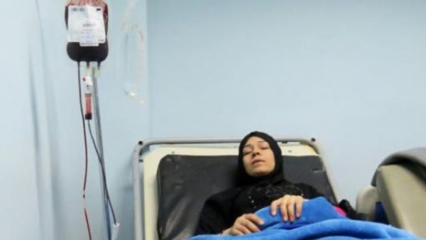 إمرأة سورية تتعالج في مستشفى في دمشق بعد اصابتها بصاروخ اطلقته فصائل معارضة على سوق تجارية مزدحمة في منطقة جرمانة
