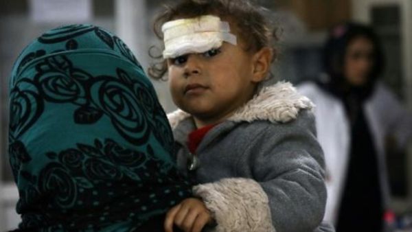 طفل اصيب في المعارك بين القوات العراقية والجهاديين في الموصل

