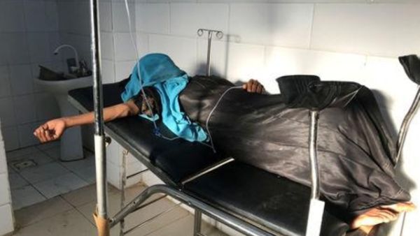 امرأة من النازحين في مستشفى المخا باليمن
