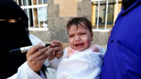 حملة تلقيح للأطفال في العاصمة صنعاء

