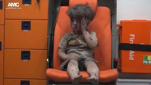 الطفل السوري عمران