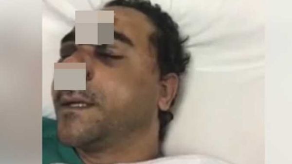 المصري المعتدى عليه من قبل شاب كويتي