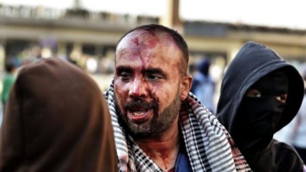 متظاهر جريح في تضارب بين مؤيدي ومعارضي الرئيس مرسي/أ.ف.ب