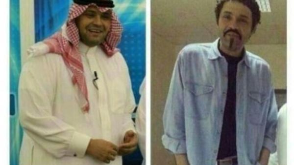 الفنان يوسف الجراح قبل وبعد الجراحة. 