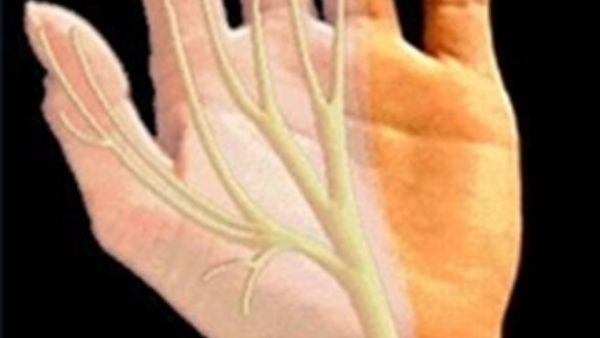 الخدران أو التنميل في اليد هو إحساس المريض بخدران أو بوخز كالابر أو عدم الراحة أو حرارة  الخدران أو التنميل في اليد هو إحساس المريض بخدران أو بوخز كالابر أو عدم الراحة أو حرارة