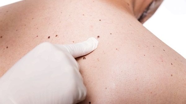 لا يوجد لديك طبيب أمراض جلدية؟ اعثر على طبيب بالقرب منك.