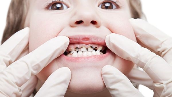الوقاية خير من العلاج