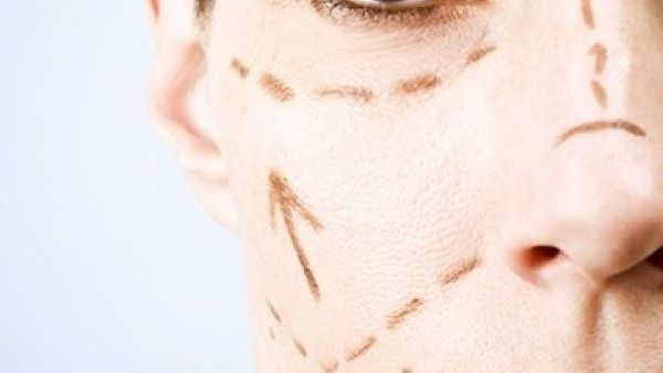 تخطيط مبدئي يسبق عملية شد الوجه