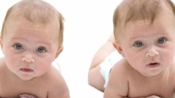 صورة تعبيرية لتوائم  صورة تعبيرية لتوائم