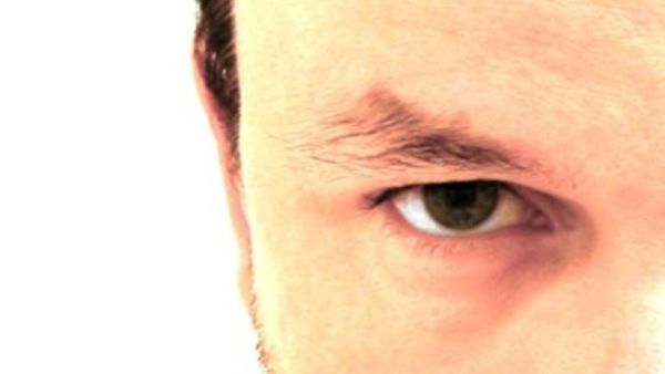معالجة فقدان الشعر يمكن أن تؤثر على الإنتصاب؟