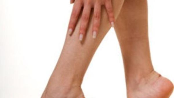 3 علاجات طبيعية لعروق الدوالي أثناء الحمل