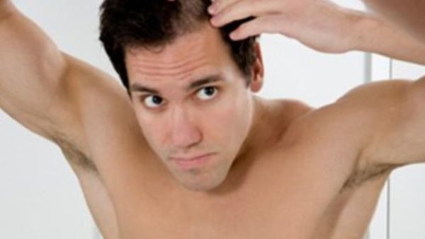 يجب استشارة الطبيب قبل البدء باستعمال اي علاج للصلع