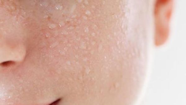 صورة توضيحية 