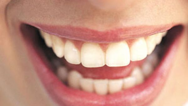 أسنانك المتسخة قد تكون سببا للاصابة بامراض القلب أسنانك المتسخة قد تكون سببا للاصابة بامراض القلب