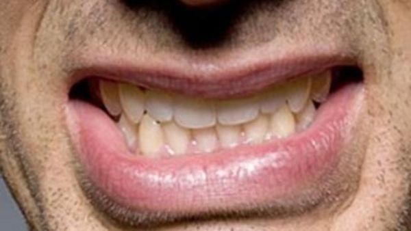 دليل مشاكل الاسنان التجميلة ‏‏