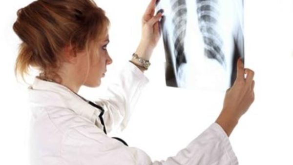  

الأشعة السينية X ray، هي نوع من الأشعة الكهرومغناطيسية بطول الموجة من 10 إلى 0.01 نانو متر