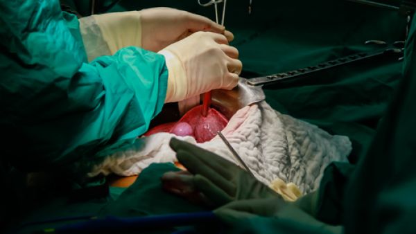 عملية زراعة الكبد هي عمليّة يتم فيها نقل جزء من كبد سليمة إلى شخص مصاب بالفشل الكلوي