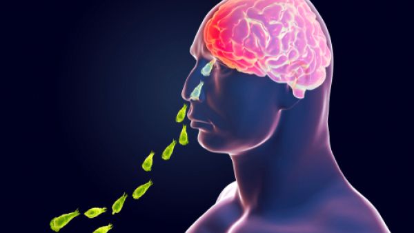 من أعراض داء التهاب السحايا تيّبس في الرقبة
