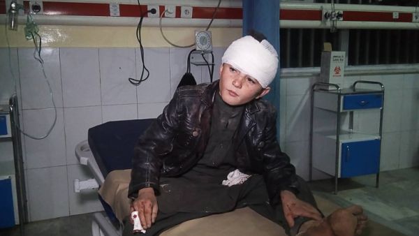 A young wounded Afghan boy receives treatment at Wazir Akbar Khan hospital in Kabul on November 28, 2018. (AFP/File)