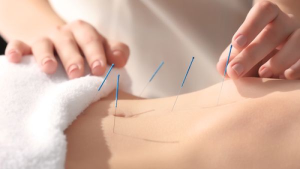 الإبر الصينية تعالج حالات الأرق والإرهاق
