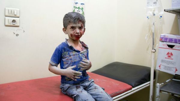 A Syrian boy awaits treatment at a make-shift hospital following air strikes on rebel-held eastern areas of Aleppo. (AFP/Karam al-Masri)