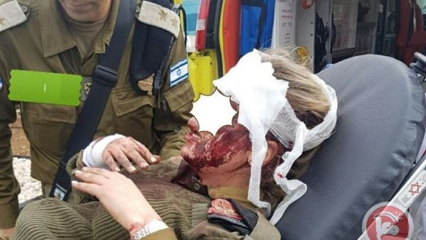 المجند والمجندة الاسرائيليين أصيبا بجروح في الرأس نتيجة تعرضهما لإلقاء الحجارة 