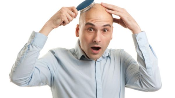 دراسة:علاج الصلع عند الرجال يحمي من سرطان البروستات