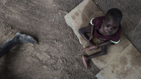 An official famine was declared in South Sudan in February, and hundreds of thousands of children are at risk of starvation. (AFP) 