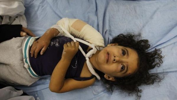 طفلة جريحة/أ.ف.ب