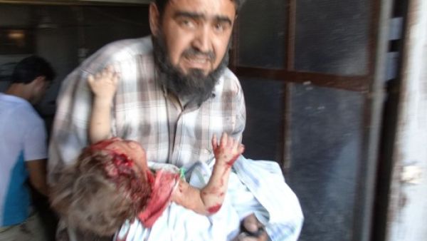 سوري يحاول اسعاف طفلته التي اصيبت خلال قصف جوي لقوات النظام في ادلب/أ.ف.ب