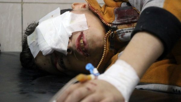أحد الأطفال الجرحى من مدينة حلب