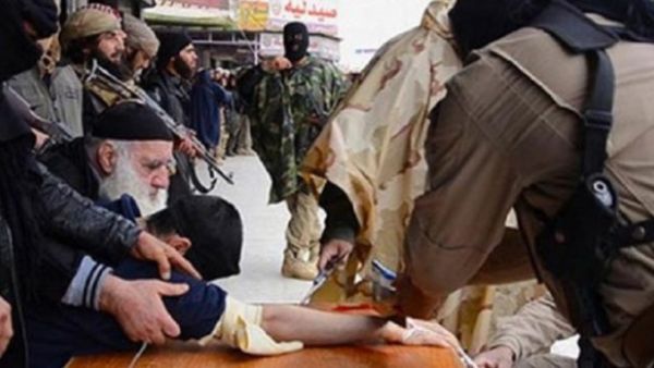 قطع يد طفل وقدم رجل، في قرية الحصان بريف دير الزور الغربي