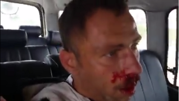 انتحاري حاول تفجير نفسه بالقرب من مستشفى جبلة