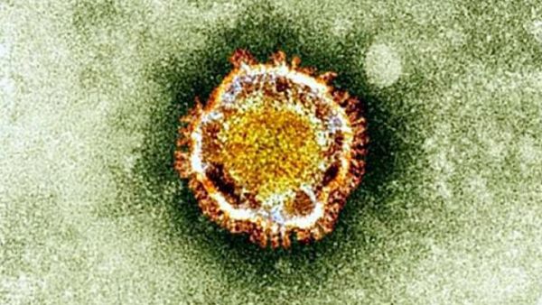 Coronavirus seen under an electron miscroscope (British Health Protection Agency/ AFP)
