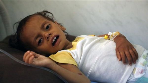 A Yemeni child receives treatment at a hospital in the coastal city of Hudaydah on November 11, 2017. (AFP/ File Photo)
