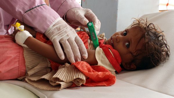 A Yemeni child suspected of being infected with cholera is checked by a doctor at a makeshift hospital. (AFP) 